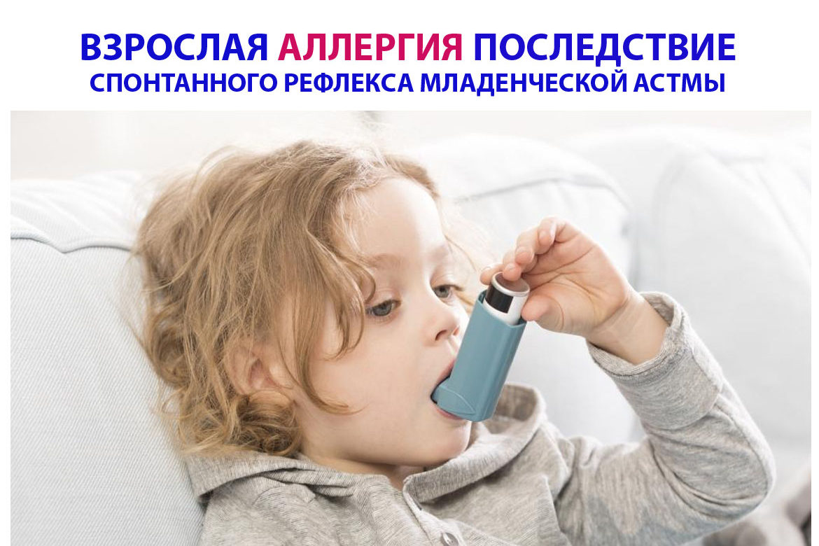 ВЗРОСЛАЯ АЛЛЕРГИЯ