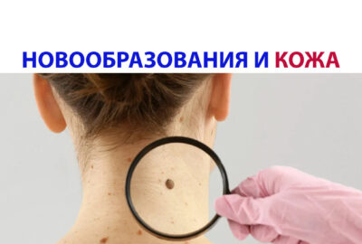 Новообразования на коже