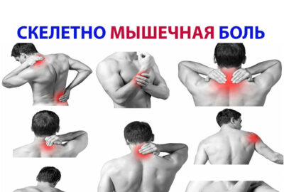 Скелетно-мышечная боль